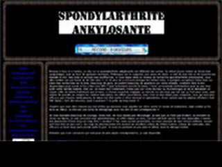 Spondylarthrite ankylosante